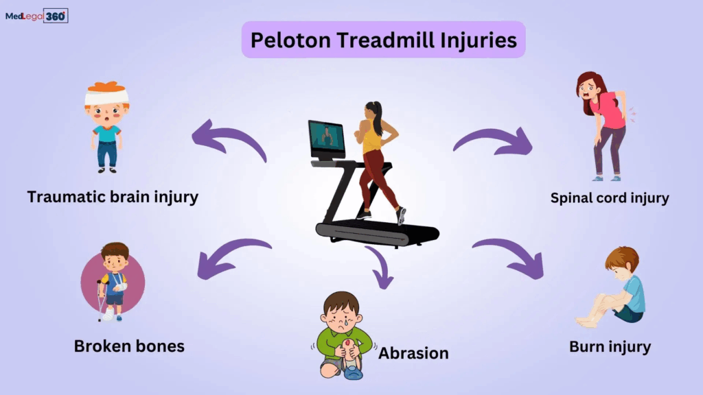 Peloton injury diagram